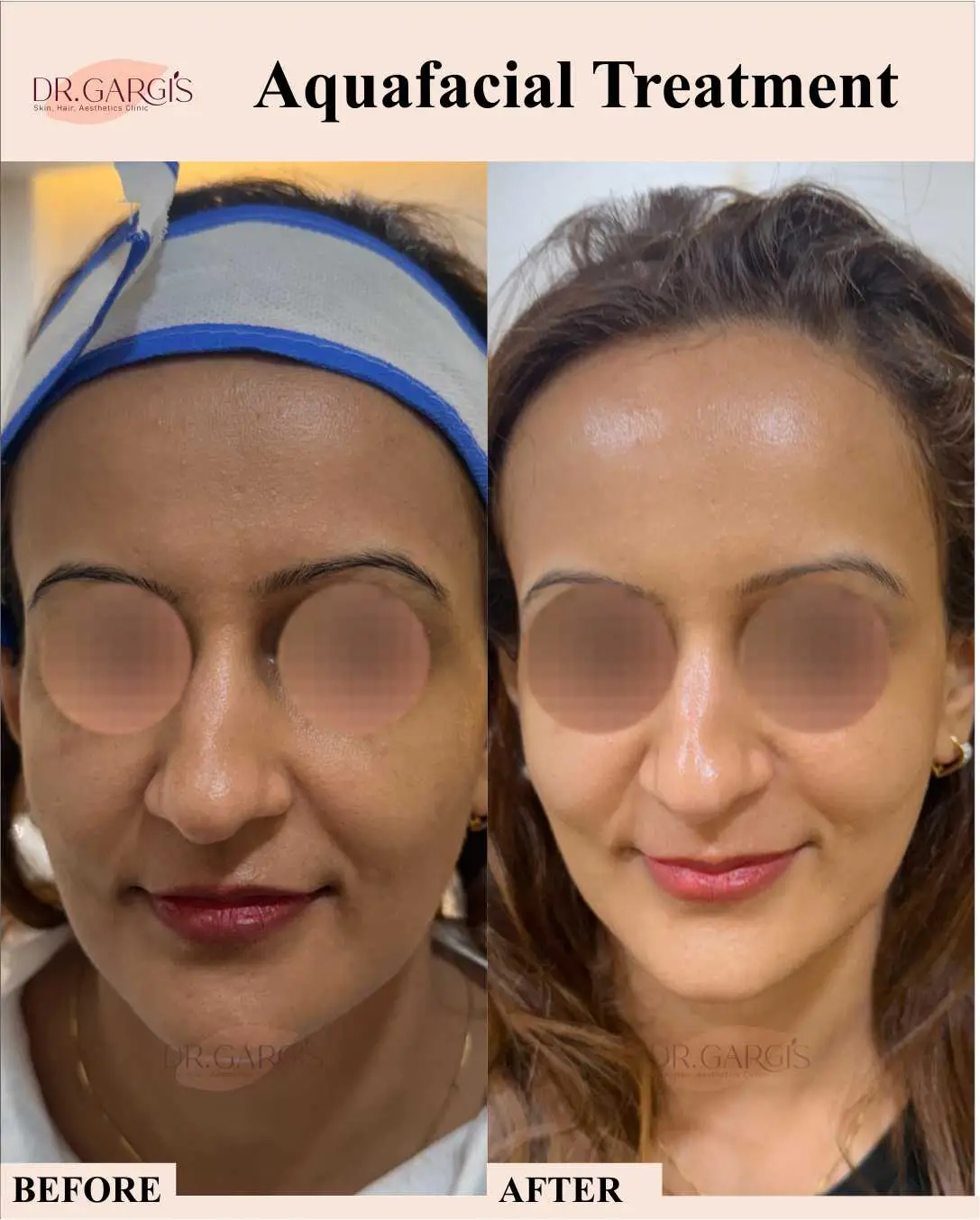 Before and After Result 3