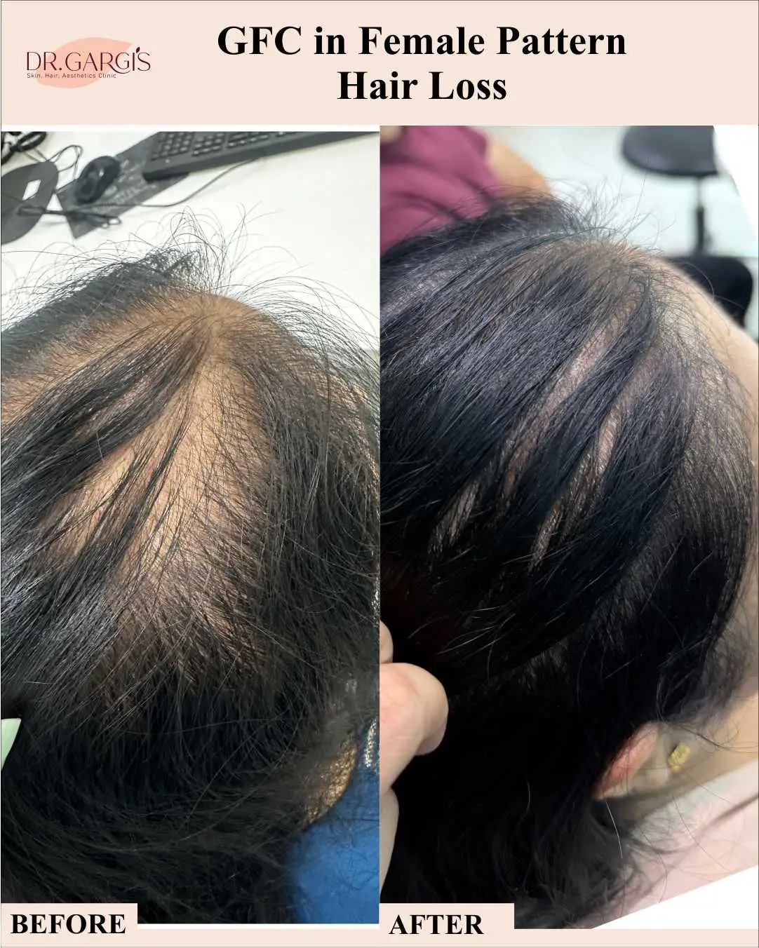 Before and After Result 4