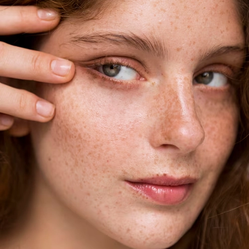 Pigmentation